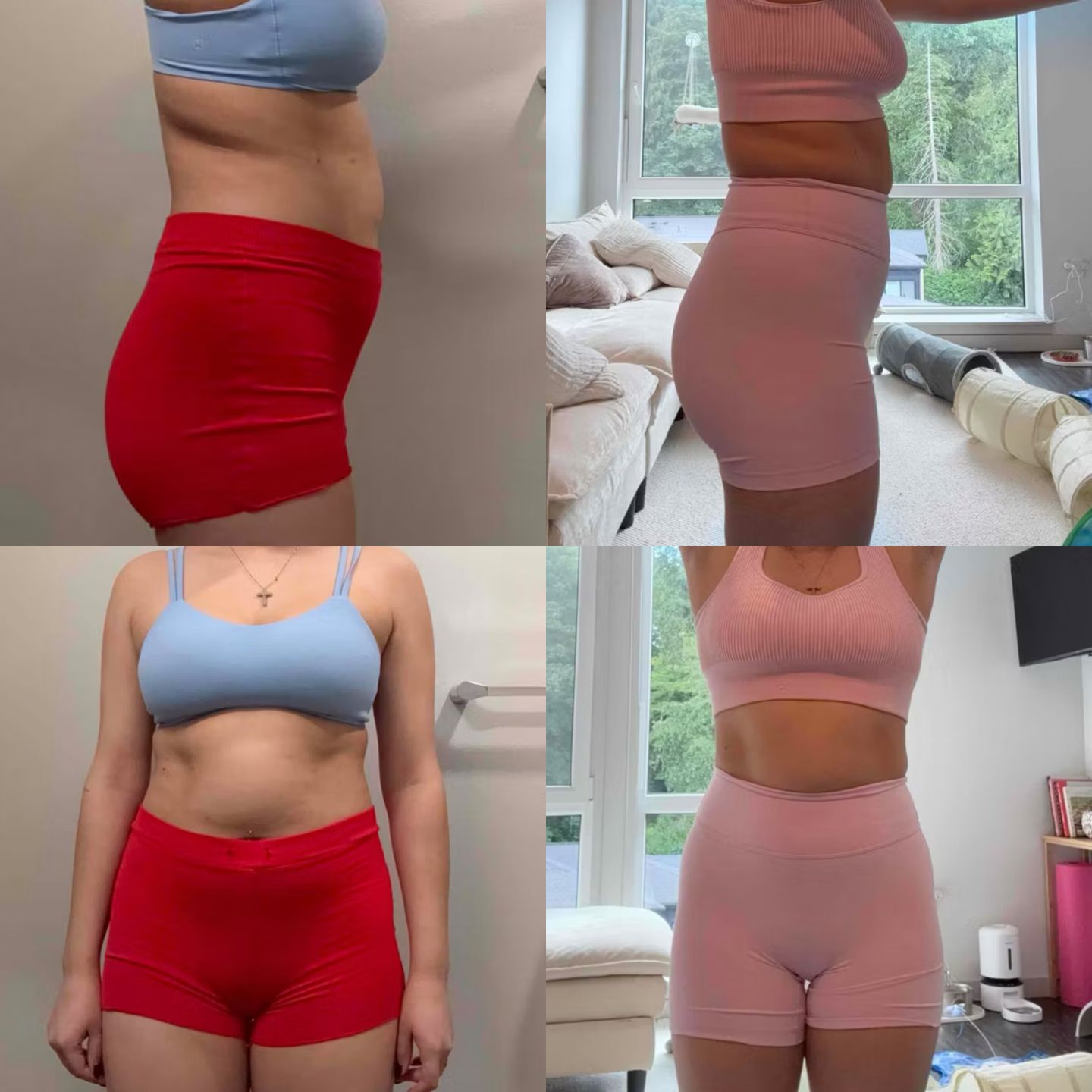 Client side and front before and after