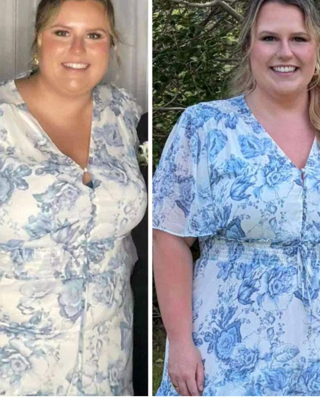 Transformation