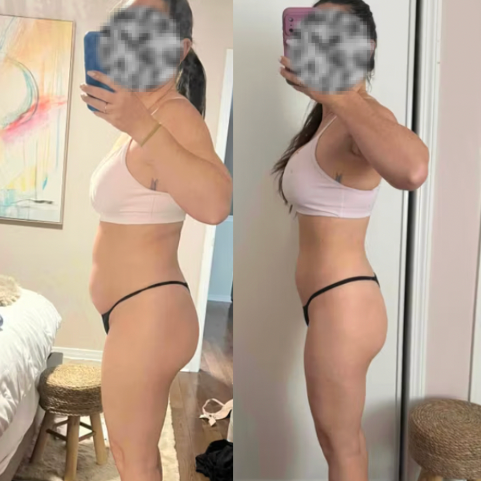 Transformation