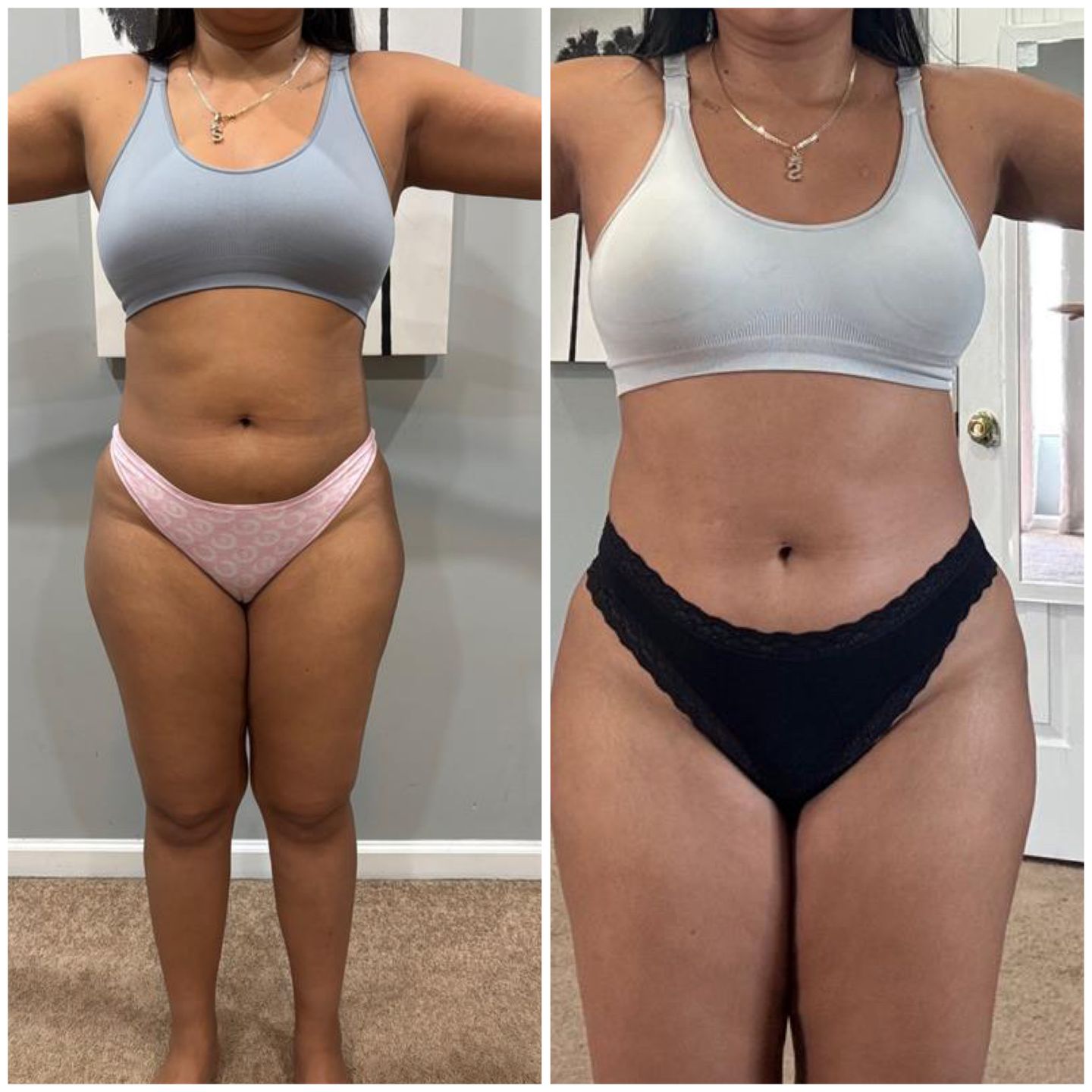 Transformation