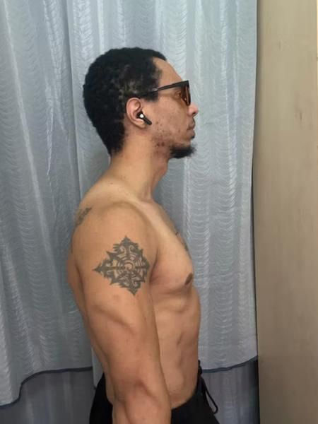 Same client, side view, now