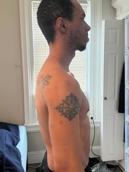 Same client, side view, at the start