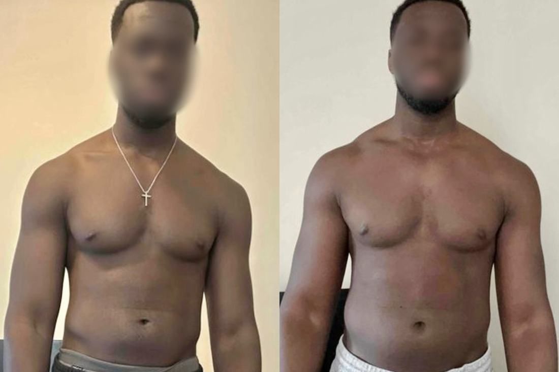 Client transformation 7, front view before and after