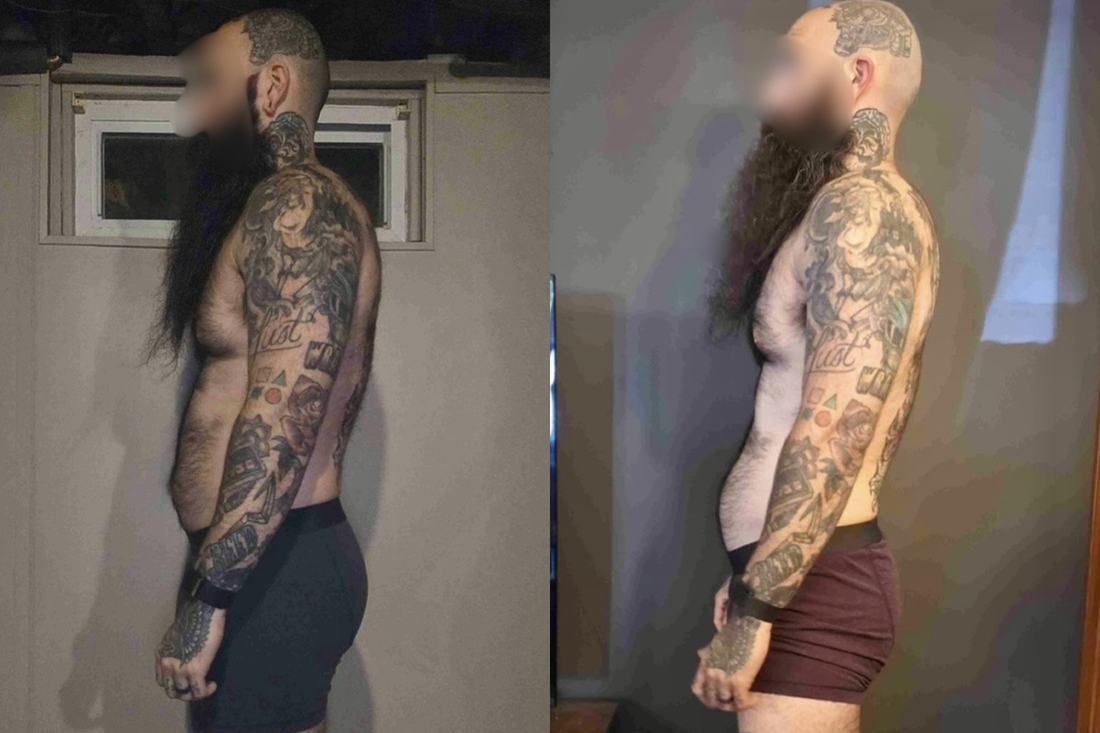 Client transformation 9, side view before and after