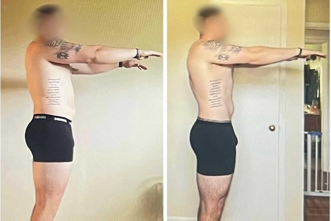 Client transformation 6, side view before and after