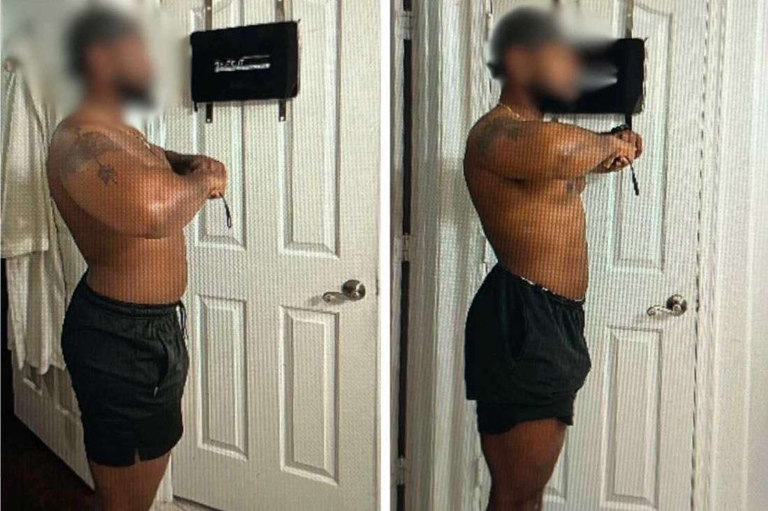 Client transformation 5, side view before and after